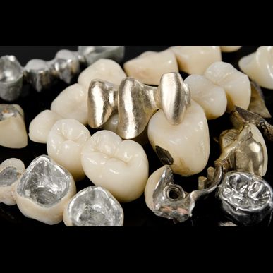 石川でパラジウム等歯科用金属の買い取りならエチュード