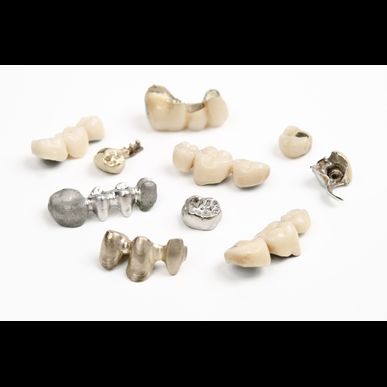 石川の当社は金パラ等歯科用金属の買い取りをします