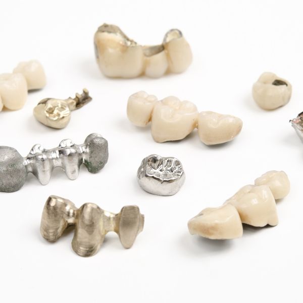 石川の当社は金パラ等歯科用金属の買い取りをします