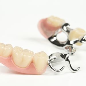 石川で歯科用金属のパラジウムを高価買い取りいたします