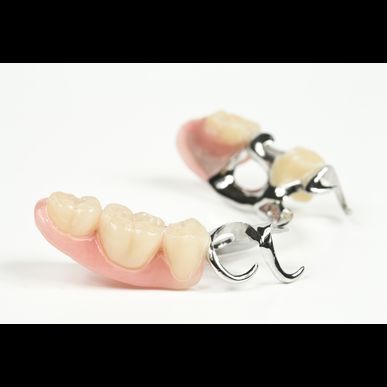 石川で歯科用金属のパラジウムを高価買い取りいたします